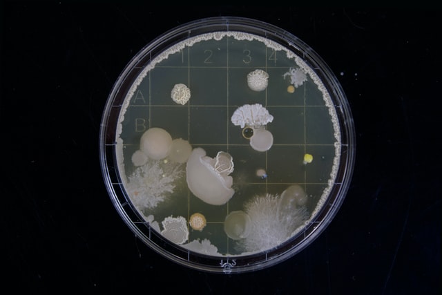 petri-dish-bacteria